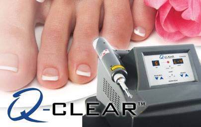 Q-Clear Laser Treatment for Fungal Toenails